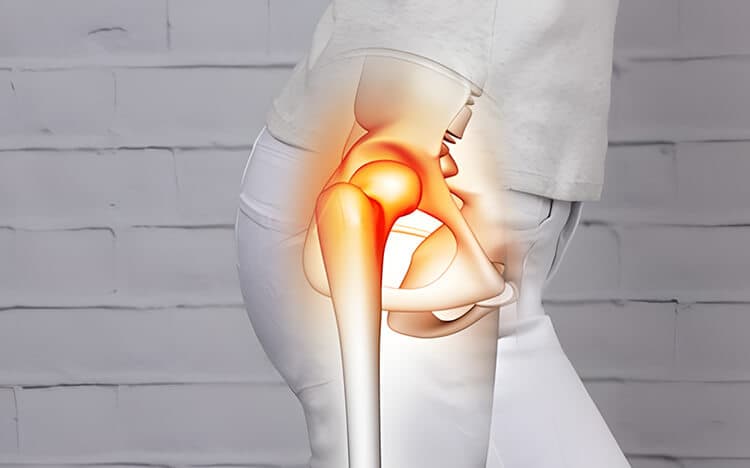 Desgaste de cadera y rodilla