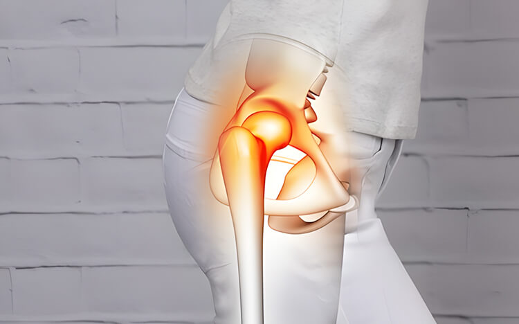 Desgaste de cadera y rodilla